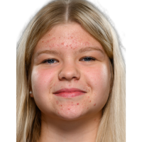Enija Brokane